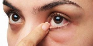 دراسة علمية جديدة تكشف أسباب جفاف العين - موقع رادار